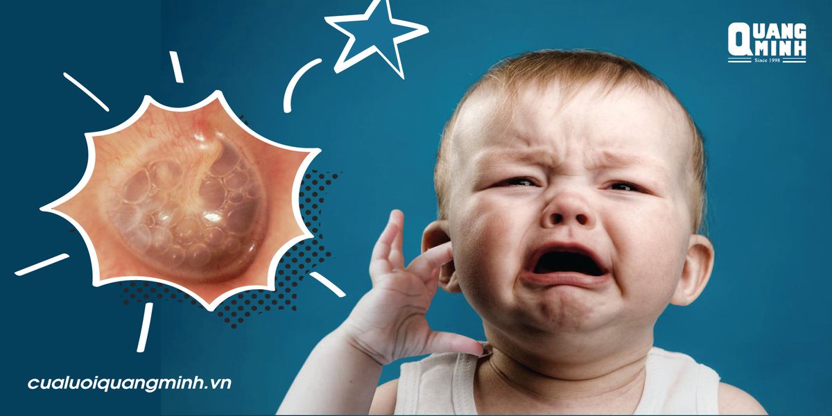 ảnh bìa viêm tai giữa ở trẻ